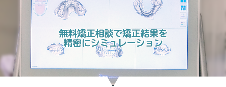 無料矯正相談で矯正結果を精密にシミュレーション