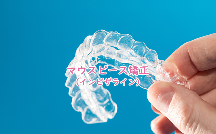 マウスピース矯正